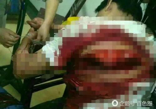 广西打架案件爆料最新,冲突升级,警方介入调查